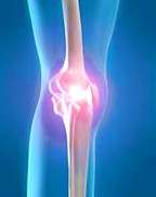 Артроз колена лечение в киеве thumbnail